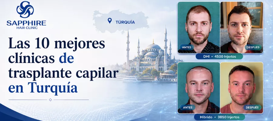 Las 10 mejores clínicas de trasplante capilar en Turquía