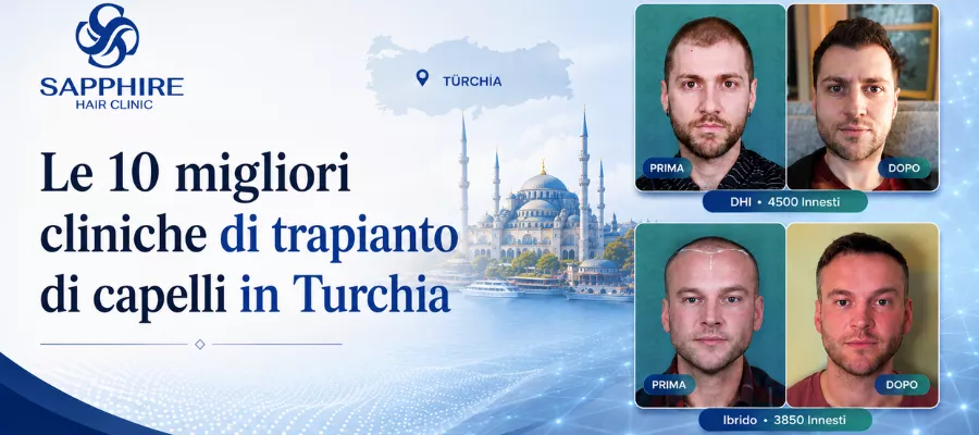 Le 10 migliori cliniche per il trapianto di capelli in Turchia