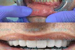 dental_before_after_2