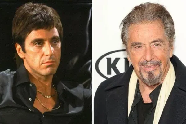 Al Pacino Hair Transplant