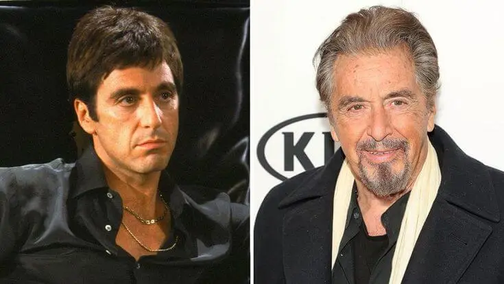 Al Pacino Hair Transplant
