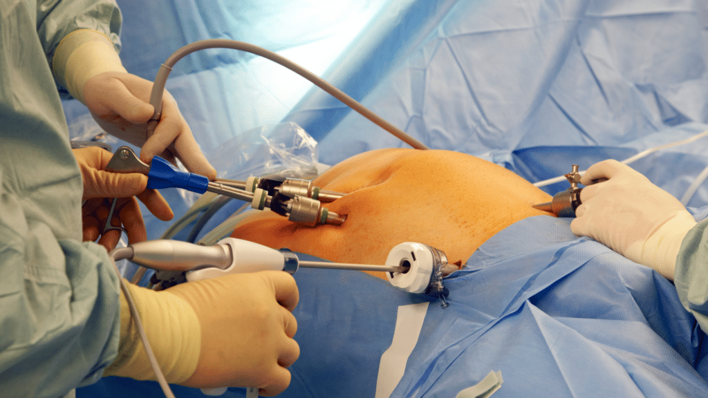 Bariatric Surgery Turkey