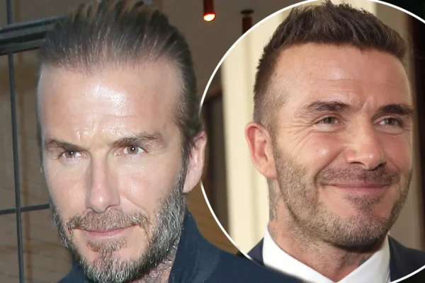 David Beckham Hair Transplant