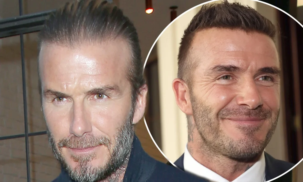 David Beckham Hair Transplant