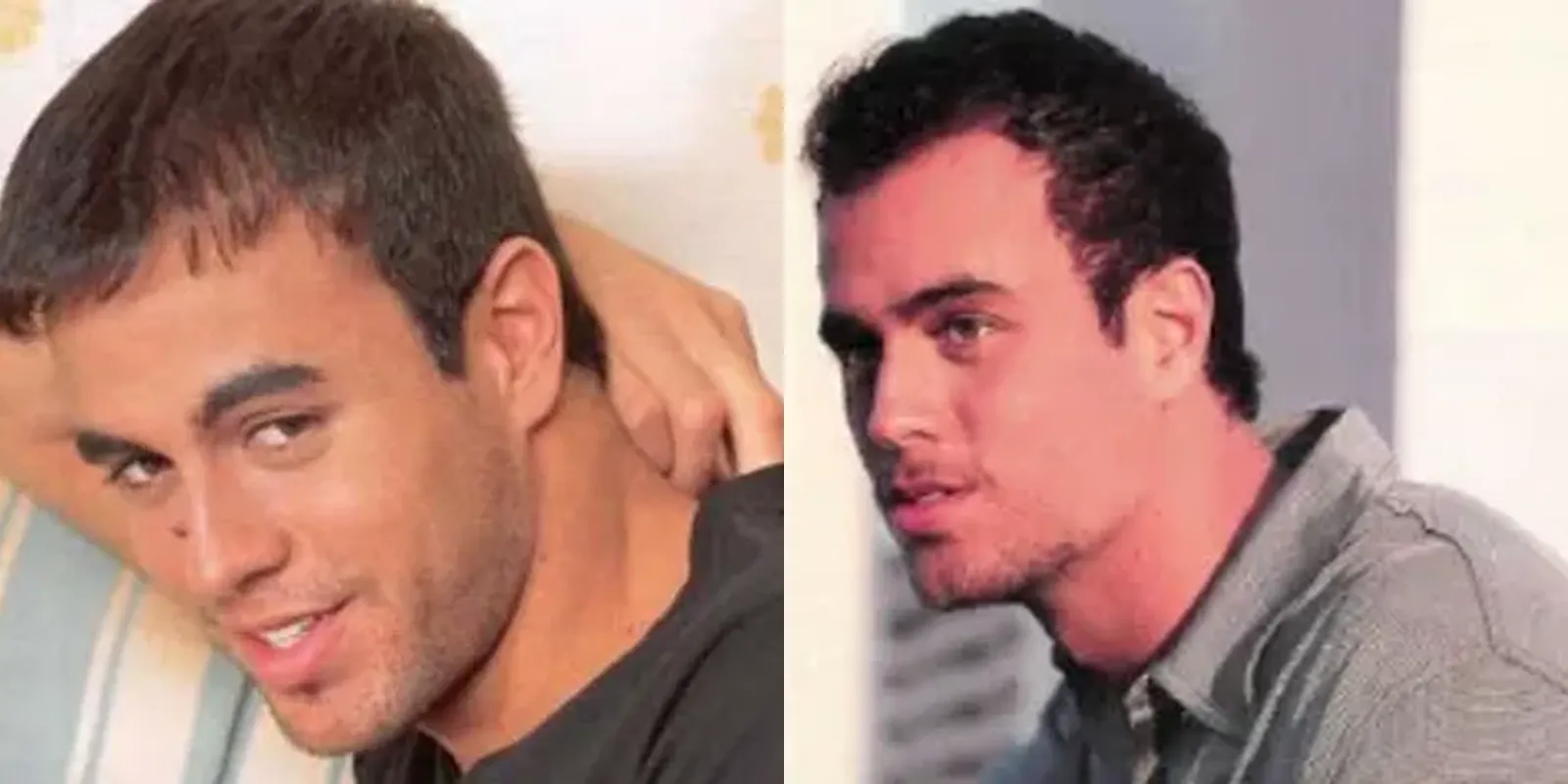 Enrique Iglesias Hair Transplant