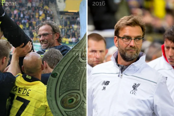 Jürgen Klopp Hair Transplant