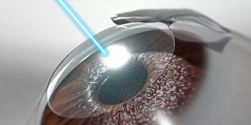 Lasik Turkey