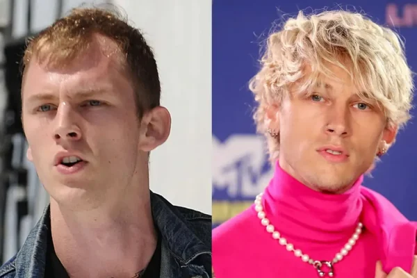 Machine Gun Kelly Hair Transplant