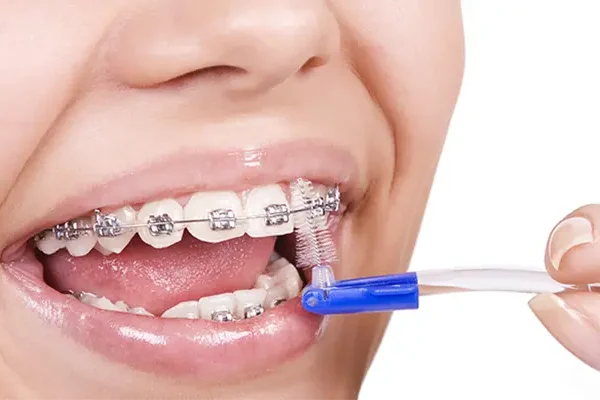 Orthodontics Turkey