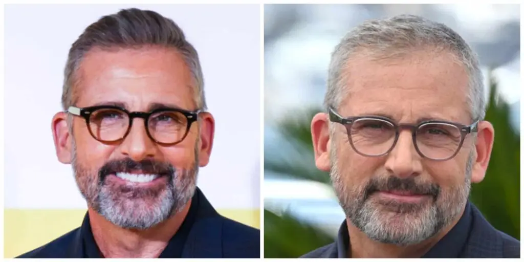 Steve Carell Hair Transplant
