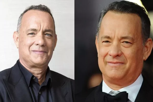 Tom Hanks Hair Transplant