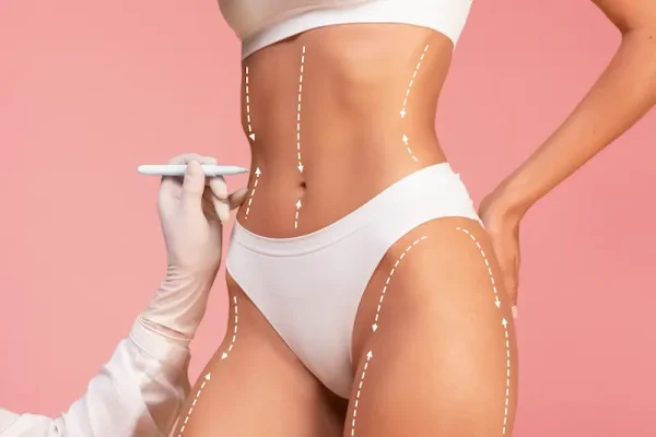 Vaser Liposuction Turkey
