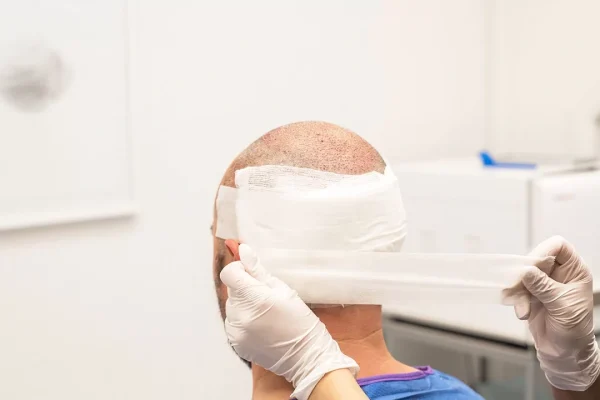 When Should the Bandage Be Removed After Hair Transplant?