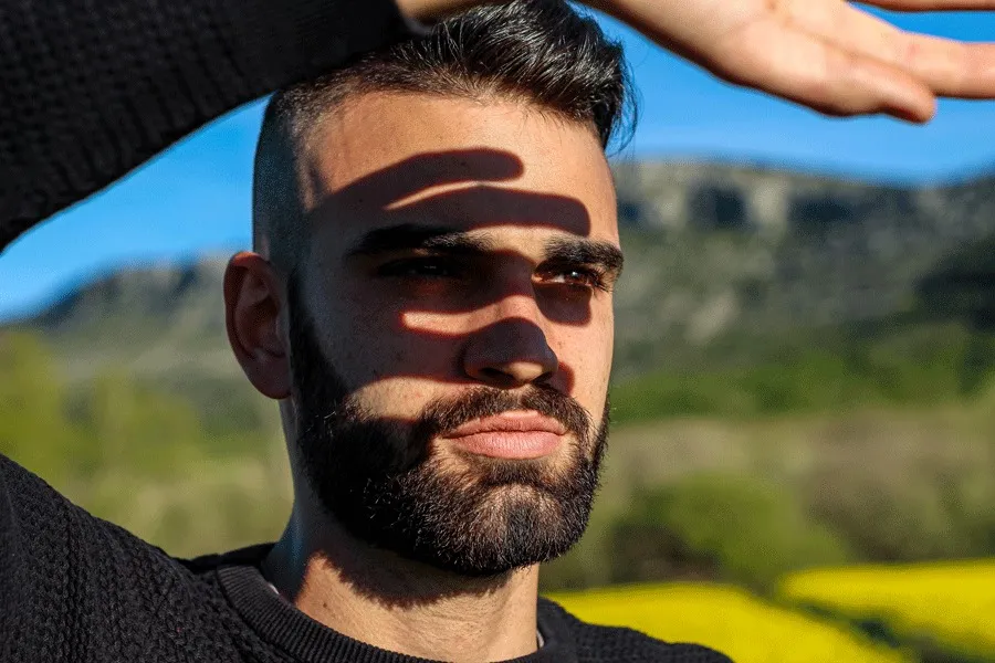 Sun Effects After Hair Transplantation
