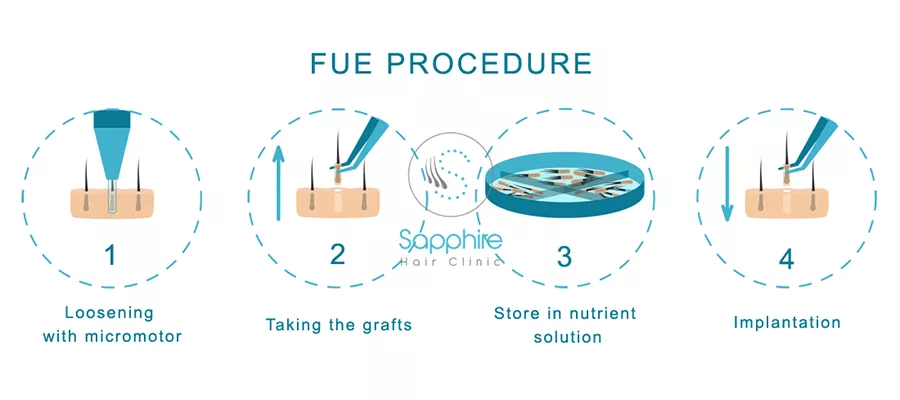 Manuelle Fue Haartransplantation