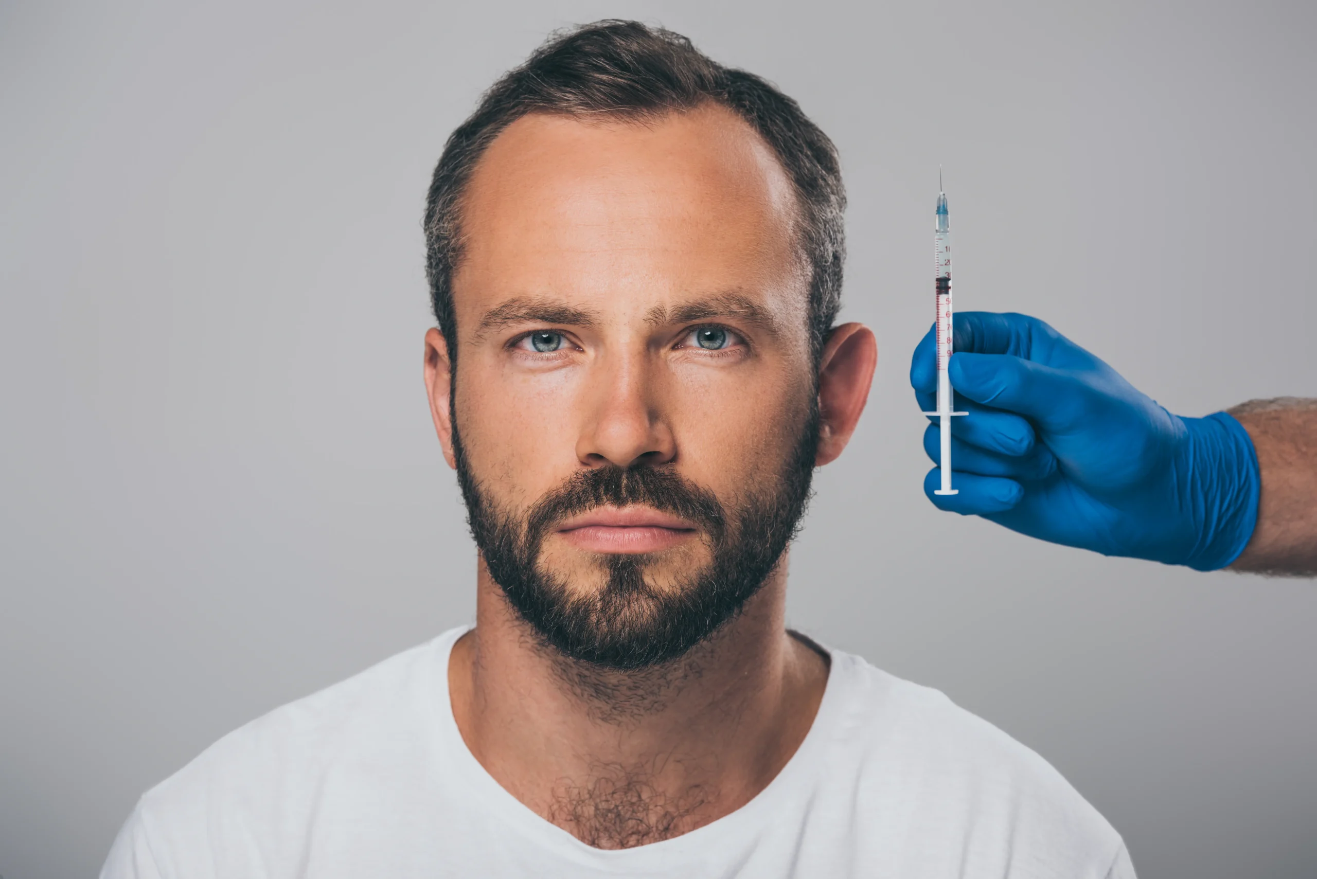 Stem Cell Hair Transplant