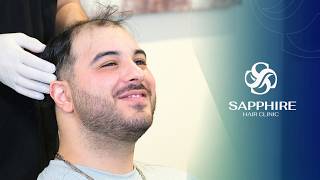 Hair Transplant Experience | Sapphire Hair Clinic